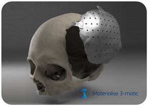 Materialise 3-Matic Medical / Research v12.0 Materialise 3-Matic Medical / Research v12.0